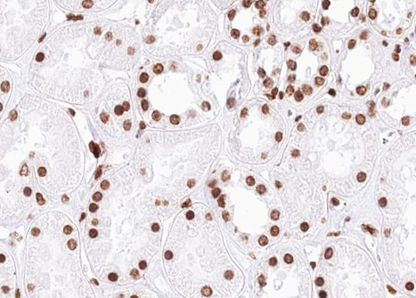SMC1A / SMC1 Antibody - 1:100 staining human kidney tissue by IHC-P. The tissue was formaldehyde fixed and a heat mediated antigen retrieval step in citrate buffer was performed. The tissue was then blocked and incubated with the antibody for 1.5 hours at 22°C. An HRP conjugated goat anti-rabbit antibody was used as the secondary.