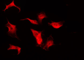 SMC1A / SMC1 Antibody - Staining HuvEc cells by IF/ICC. The samples were fixed with PFA and permeabilized in 0.1% Triton X-100, then blocked in 10% serum for 45 min at 25°C. The primary antibody was diluted at 1:200 and incubated with the sample for 1 hour at 37°C. An Alexa Fluor 594 conjugated goat anti-rabbit IgG (H+L) Ab, diluted at 1/600, was used as the secondary antibody.