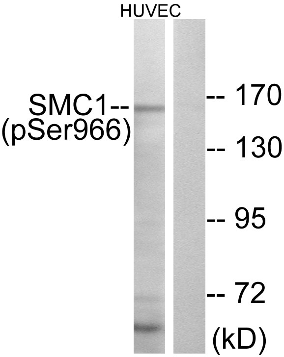 SMC1A / SMC1 Antibody - Western blot analysis of lysates from HUVEC cells treated with etoposide 24uM 24h, using SMC1 (Phospho-Ser966) Antibody. The lane on the right is blocked with the phospho peptide.