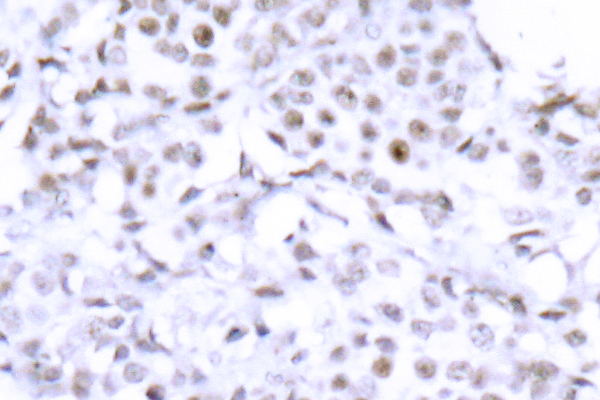 SMC1A / SMC1 Antibody - IHC of SMC1 (S951) pAb in paraffin-embedded human brain tissue.