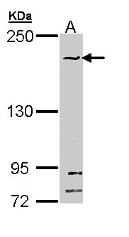 SMC1B Antibody - Sample (30 ug of whole cell lysate). A: Hela. 5% SDS PAGE. SMC1B antibody diluted at 1:1000.