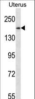 SMC1B Antibody - SMC1B Antibody western blot of human normal Uterus tissue lysates (35 ug/lane). The SMC1B antibody detected the SMC1B protein (arrow).