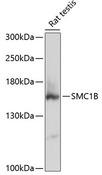 SMC1B Antibody - Western blot analysis of extracts of rat testis using SMC1B Polyclonal Antibody at dilution of 1:3000.