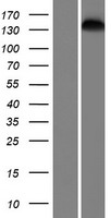 SMC1B Protein - Western validation with an anti-DDK antibody * L: Control HEK293 lysate R: Over-expression lysate