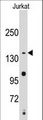 SMC2 Antibody - Western blot of anti-SMC2 Antibody in Jurkat cell line lysates (35 ug/lane). SMC2(arrow) was detected using the purified antibody.
