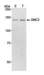 SMC2 Antibody - Detection of Human SMC2 by Western Blot. Samples: Whole cell lysate (90 ug) from mock transfected (E) or SMC2 transfected (T) HEK293T cells. Antibody: Affinity purified rabbit anti-SMC2 used at 0.1 ug/ml. Detection: Chemiluminescence with a 10 minute exposure.