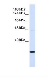 SMC2 Antibody - Transfected 293T cell lysate. Antibody concentration: 1.0 ug/ml. Gel concentration: 6-18%.  This image was taken for the unconjugated form of this product. Other forms have not been tested.