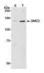 SMC2 Antibody - Detection of Human SMC2 by Western Blot. Samples: Whole cell lysate (90 ug) from mock transfected (E) or SMC2 transfected (T) HEK293T cells. Antibody: Affinity purified rabbit anti-SMC2 used at 0.1 ug/ml. Detection: Chemiluminescence with a 10 minute exposure.