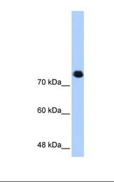 SMC3 / HCAP Antibody - HepG2 cell lysate. Antibody concentration: 0.25 ug/ml. Gel concentration: 8%.  This image was taken for the unconjugated form of this product. Other forms have not been tested.