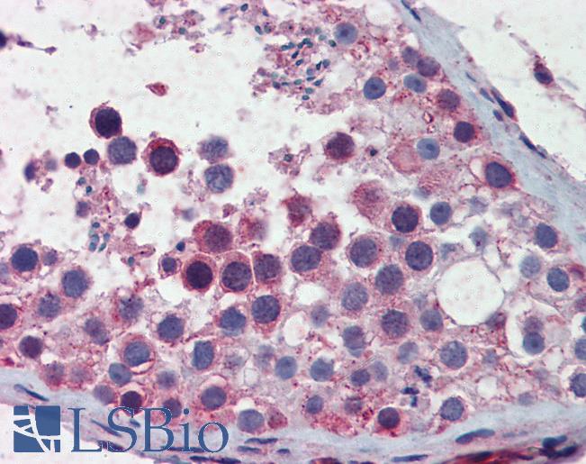 SMC3 / HCAP Antibody - Anti-SMC3 antibody IHC of human testis. Immunohistochemistry of formalin-fixed, paraffin-embedded tissue after heat-induced antigen retrieval. Antibody concentration 5 ug/ml.  This image was taken for the unconjugated form of this product. Other forms have not been tested.