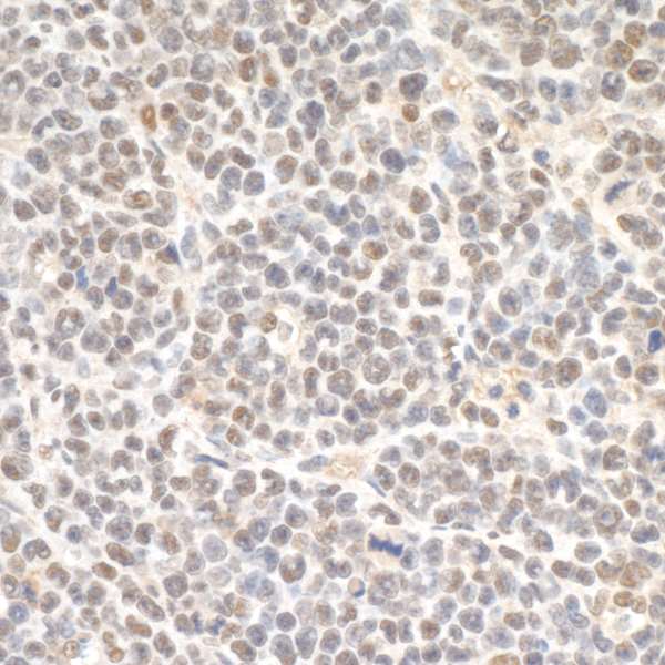 SMC3 / HCAP Antibody - Detection of mouse SMC3 by immunohistochemistry. Sample: FFPE section of mouse plasmacytoma. Antibody: Affinity purified rabbit anti-SMC3 used at 1:1,000 (1µg/ml). Detection: DAB