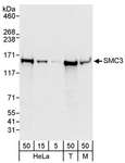 SMC3 / HCAP Antibody - Detection of Human and Mouse SMC3 by Western Blot. Samples: Whole cell lysate from HeLa (5, 15 and 50 ug), 293T (T; 50 ug) and mouse NIH3T3 (M; 50 ug) cells. Antibody: Affinity purified rabbit anti-SMC3 antibody used for WB at 0.04 ug/ml. Detection: Chemiluminescence with an exposure time of 30 seconds.