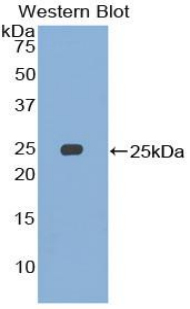 SMC3 / HCAP Antibody - Western blot of recombinant SMC3 / HCAP.  This image was taken for the unconjugated form of this product. Other forms have not been tested.
