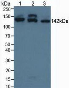SMC3 / HCAP Antibody - Western Blot; Sample: Lane1: Human HepG2 Cells; Lane2: Human Hela Cells; Lane3: Human Jurkat Cells.