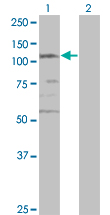 SMC3 / HCAP Antibody - Western blot of SMC3 expression in transfected 293T cell line by CSPG6 monoclonal antibody (M02), clone 2F11.