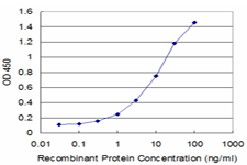 SMC3 / HCAP Antibody - Detection limit for recombinant GST tagged CSPG6 is approximately 0.3 ng/ml as a capture antibody.
