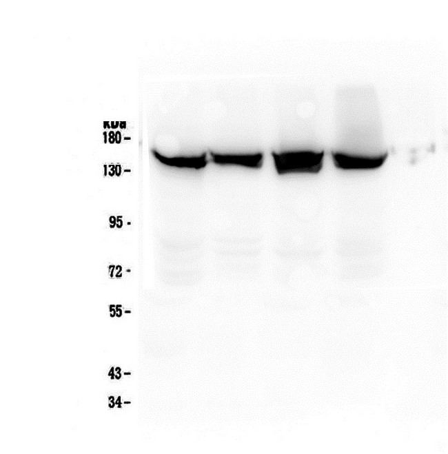 SMC3 / HCAP Antibody - Western blot analysis of SMC3 using anti-SMC3 antibody. Electrophoresis was performed on a 8% SDS-PAGE gel at 70V (Stacking gel) / 90V (Resolving gel) for 2-3 hours. The sample well of each lane was loaded with 50ug of sample under reducing conditions. Lane 1: human Hela whole cell lysate,Lane 2: human A549 whole cell lysate,Lane 3: human MCF-7 whole cell lysate,Lane 4: human MDA-MB-453 whole cell lysate. After Electrophoresis, proteins were transferred to a Nitrocellulose membrane at 150mA for 50-90 minutes. Blocked the membrane with 5% Non-fat Milk/ TBS for 1.5 hour at RT. The membrane was incubated with mouse anti-SMC3 antigen affinity purified monoclonal antibody at 0.5 µg/mL overnight at 4°C, then washed with TBS-0.1% Tween 3 times with 5 minutes each and probed with a goat anti-mouse IgG-HRP secondary antibody at a dilution of 1:10000 for 1.5 hour at RT. The signal is developed using an Enhanced Chemiluminescent detection (ECL) kit with Tanon 5200 system.