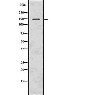 SMC3 / HCAP Antibody - Western blot analysis SMC3 using K562 whole cells lysates
