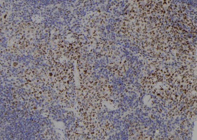 SMC3 / HCAP Antibody - 1:100 staining mouse spleen tissue by IHC-P. The sample was formaldehyde fixed and a heat mediated antigen retrieval step in citrate buffer was performed. The sample was then blocked and incubated with the antibody for 1.5 hours at 22°C. An HRP conjugated goat anti-rabbit antibody was used as the secondary.