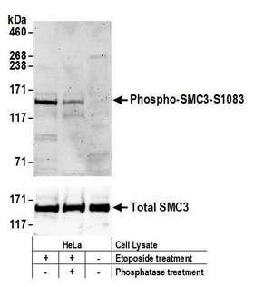 SMC3 / HCAP Antibody - Detection of human Phospho SMC3 (S1083) by western blot (WB). Samples: Whole cell lysate (50 µg) from HeLa cells treated with 100 µM etoposide and/or 100 µM phosphatase for 4 hours (+) or mock treated (-) cells. Antibodies: Affinity purified rabbit anti-Phospho SMC3 (S1083) antibodyused for WB at 1 µg/ml (upper panel); to detect total SMC3, rabbit anti-SMC3 was used for WB at 0.1 µg/ml (lower panel). Detection: Chemiluminescence with an exposure time of 3 minutes (upper panel) or 10 seconds (lower panel).