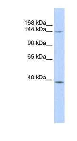 SMC4 Antibody - SMC4 antibody Western blot of MCF7 cell lysate. This image was taken for the unconjugated form of this product. Other forms have not been tested.