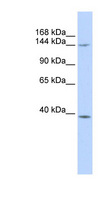 SMC4 Antibody - SMC4 antibody Western blot of MCF7 cell lysate. This image was taken for the unconjugated form of this product. Other forms have not been tested.