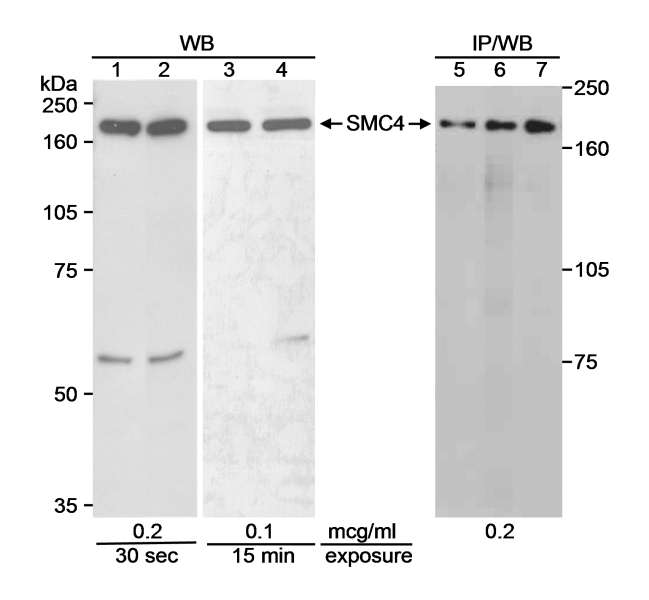 SMC4 Antibody - Detection of Human SMC4 by Western Blot and Immuno-precipitation. Samples: Whole cell lysate (90 ug for WB; 0.5 mg for IP/WB) from 293T cells (lanes 1, 3 and 5), normal human lymphoblasts (lane 2) or SMC4 transfected 239T cells (lanes 4, 6 and 7) separated on an 8% SDS-PAGE gel. Antibodies: Affinity purified rabbit anti-SMC4 used at 0.2 or 0.1 ug/ml for WB and 5 ug for IP. Detection: Chemiluminescence with the indicated exposure times.