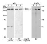 SMC4 Antibody - Detection of Human SMC4 by Western Blot and Immuno-precipitation. Samples: Whole cell lysate (90 ug for WB; 0.5 mg for IP/WB) from 293T cells (lanes 1, 3 and 5), normal human lymphoblasts (lane 2) or SMC4 transfected 239T cells (lanes 4, 6 and 7) separated on an 8% SDS-PAGE gel. Antibodies: Affinity purified rabbit anti-SMC4 used at 0.2 or 0.1 ug/ml for WB and 5 ug for IP. Detection: Chemiluminescence with the indicated exposure times.