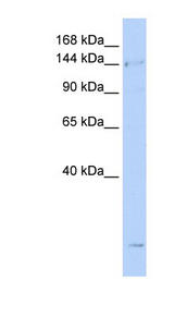 SMC4 Antibody - SMC4 antibody Western blot of Jurkat lysate. This image was taken for the unconjugated form of this product. Other forms have not been tested.
