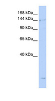 SMC4 Antibody - SMC4 antibody Western blot of Jurkat lysate. This image was taken for the unconjugated form of this product. Other forms have not been tested.