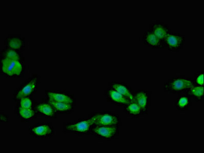 SMC4 Antibody - Immunofluorescent analysis of HepG2 cells using SMC4 Antibody at dilution of 1:100 and Alexa Fluor 488-congugated AffiniPure Goat Anti-Rabbit IgG(H+L)