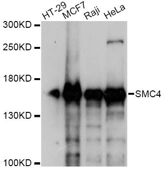 SMC4 Antibody - Western blot analysis of extracts of various cell lines, using SMC4 antibody at 1:1000 dilution. The secondary antibody used was an HRP Goat Anti-Rabbit IgG (H+L) at 1:10000 dilution. Lysates were loaded 25ug per lane and 3% nonfat dry milk in TBST was used for blocking. An ECL Kit was used for detection and the exposure time was 3s.