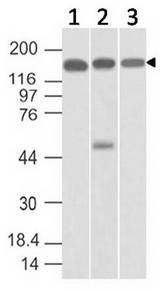 SMC4 Antibody - Fig-1: Western blot analysis of SMC4. Anti-SMC4 antibody was used at 1 µg/ml on (1) Hela, (2) 293 and (3) HepG2 lysates.