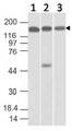 SMC4 Antibody - Fig-1: Western blot analysis of SMC4. Anti-SMC4 antibody was used at 1 µg/ml on (1) Hela, (2) 293 and (3) HepG2 lysates.