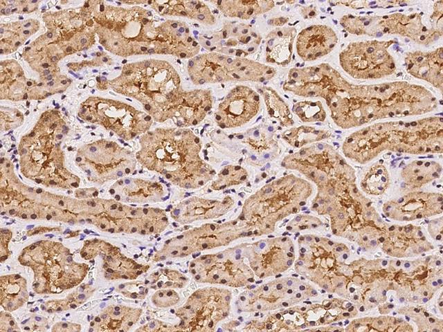 SMC4 Antibody - Immunochemical staining of human SMC4 in human kidney with rabbit polyclonal antibody at 1:500 dilution, formalin-fixed paraffin embedded sections.