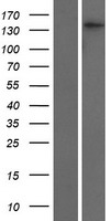 SMC4 Protein - Western validation with an anti-DDK antibody * L: Control HEK293 lysate R: Over-expression lysate