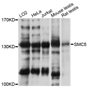 SMC5 Antibody - Western blot analysis of extracts of various cell lines.