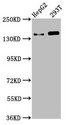 SMC5 Antibody - Positive Western Blot detected in HepG2 whole cell lysate, 293T whole cell lysate. All lanes: SMC5 antibody at 4.6 µg/ml Secondary Goat polyclonal to rabbit IgG at 1/50000 dilution. Predicted band size: 129 KDa. Observed band size: 129 KDa