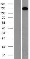 SMC5 Protein - Western validation with an anti-DDK antibody * L: Control HEK293 lysate R: Over-expression lysate