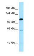 SMC6 Antibody - SMC6 antibody Western Blot of MCF7.  This image was taken for the unconjugated form of this product. Other forms have not been tested.