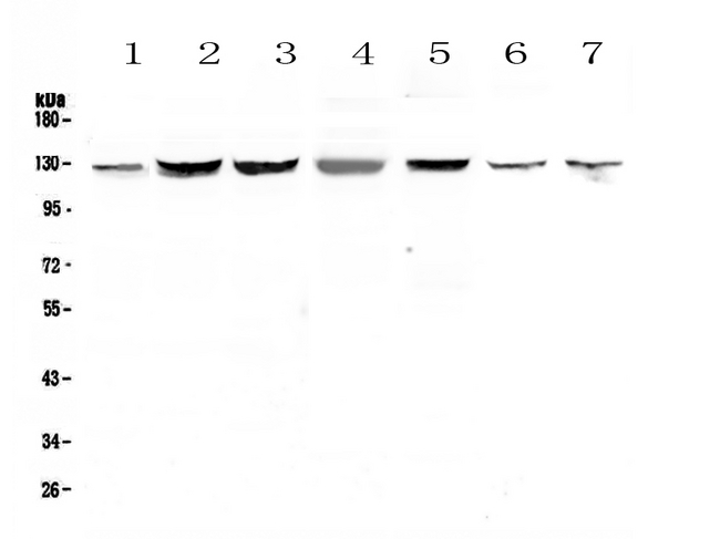 SMC6 Antibody - Western blot - Anti-SMC6L1 Picoband antibody