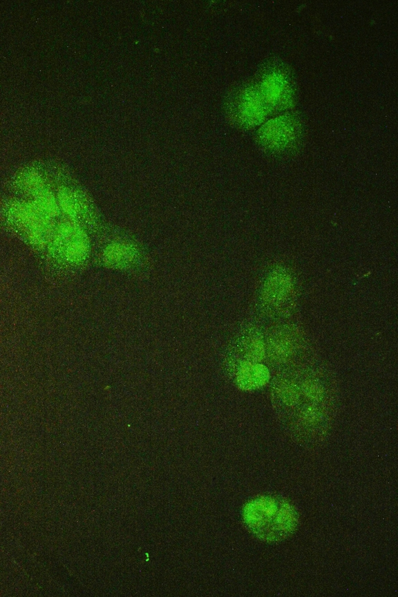 SMC6 Antibody - IF analysis of SMC6L1 using anti-SMC6L1 antibody SMC6L1 was detected in immunocytochemical section of A431 cell. Enzyme antigen retrieval was performed using IHC enzyme antigen retrieval reagent for 15 mins. The tissue section was blocked with 10% goat serum. The tissue section was then incubated with 2µg/mL rabbit anti-SMC6L1 Antibody overnight at 4°C. DyLight®488 Conjugated Goat Anti-Rabbit IgG was used as secondary antibody at 1:100 dilution and incubated for 30 minutes at 37°C. Visualize using a fluorescence microscope and filter sets appropriate for the label used.