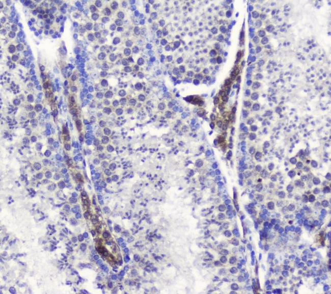 SMC6 Antibody - IHC analysis of SMC6L1 using anti-SMC6L1 antibody. SMC6L1 was detected in paraffin-embedded section of mouse testis tissue. Heat mediated antigen retrieval was performed in citrate buffer (pH6, epitope retrieval solution) for 20 mins. The tissue section was blocked with 10% goat serum. The tissue section was then incubated with 1ugµg/ml rabbit anti-SMC6L1 Antibody overnight at 4°C. Biotinylated goat anti-rabbit IgG was used as secondary antibody and incubated for 30 minutes at 37°C. The tissue section was developed using Strepavidin-Biotin-Complex (SABC) with DAB as the chromogen.
