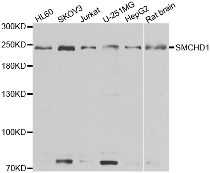 SMCHD1 Antibody - Western blot analysis of extracts of various cell lines.