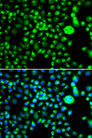 SMCHD1 Antibody - Immunofluorescence analysis of MCF7 cells.