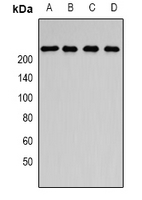 SMCHD1 Antibody - Western blot analysis of SMCHD1 expression in SKOV3 (A); Jurkat (B); HepG2 (C); rat brain (D) whole cell lysates.