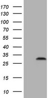 SMCO1 Antibody - HEK293T cells were transfected with the pCMV6-ENTRY control. (Left lane) or pCMV6-ENTRY C3orf43. (Right lane) cDNA for 48 hrs and lysed. Equivalent amounts of cell lysates. (5 ug per lane) were separated by SDS-PAGE and immunoblotted with anti-C3orf43. (1:2000)
