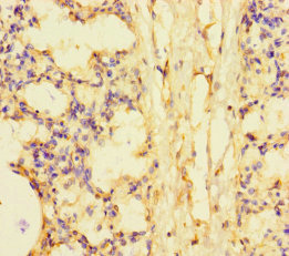 SMCO1 Antibody - Immunohistochemistry of paraffin-embedded human lung tissue using SMCO1 Antibody at dilution of 1:100