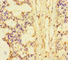 SMCO1 Antibody - Immunohistochemistry of paraffin-embedded human lung tissue using SMCO1 Antibody at dilution of 1:100