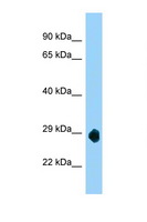 SMCO3 Antibody - LOC632209 antibody Western blot of Mouse Brain lysate. Antibody concentration 1 ug/ml.  This image was taken for the unconjugated form of this product. Other forms have not been tested.